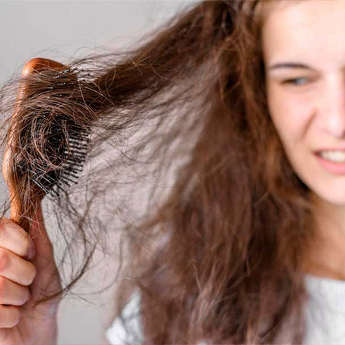 بیماری های مو